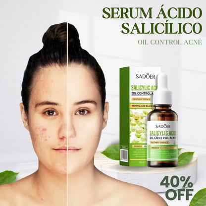 Serum Antiacné Ácido Salicílico de Sadoer - Piel fresca, sin imperfecciones.