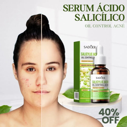 Serum Antiacné Ácido Salicílico de Sadoer - Piel fresca, sin imperfecciones.